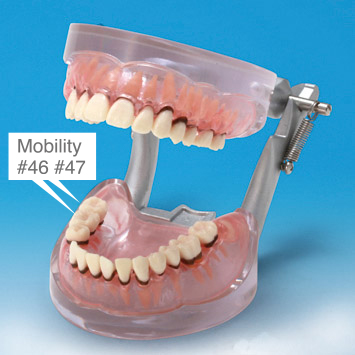 Periodontal Disease Model [PE-PER004]