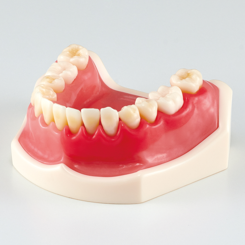 Periodontal Disease/ Peri-Implant Disease Model [PE-PER015]