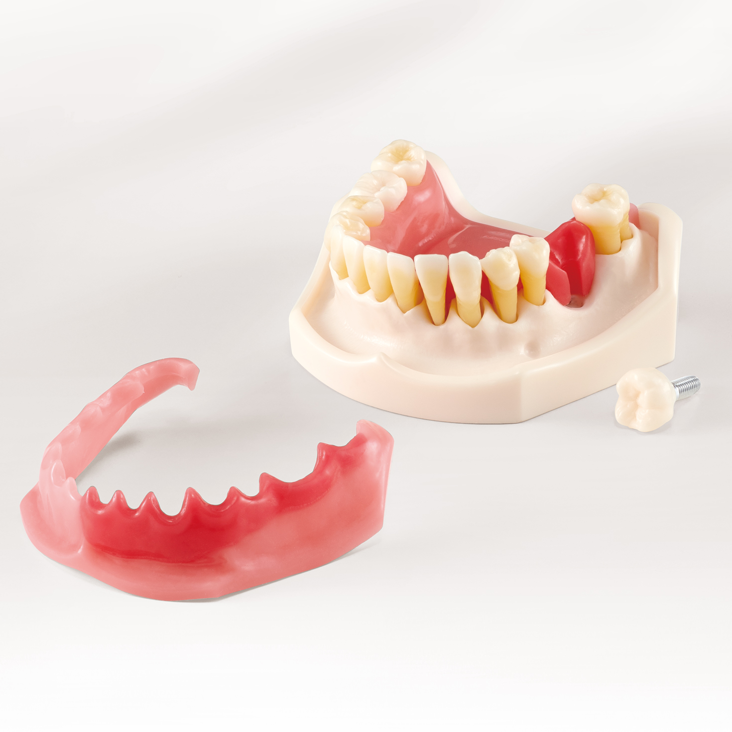 Periodontal Disease/ Peri-Implant Disease Model [PE-PER015]