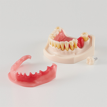 Periodontal Disease/ Peri-Implant Disease Model [PE-PER015]