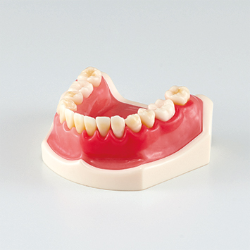 Periodontal Disease/ Peri-Implant Disease Model [PE-PER015]