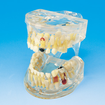 Transparent Disease Model (Primary) [PE-TDS002]