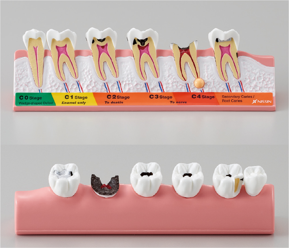 Products | Nissin Dental Products Inc. - Total Solution for Dental