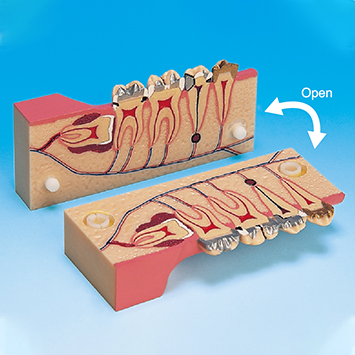 Molar Cross Section Study Model [PE-TDS007]