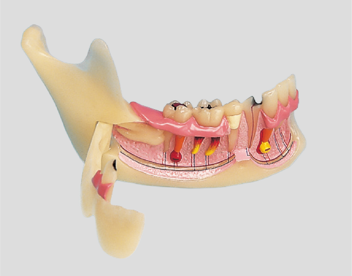 Mandibular Study Model [PE-TDS008] | Nissin Dental Products Inc