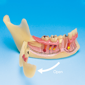 Mandibular Study Model [PE-TDS008]