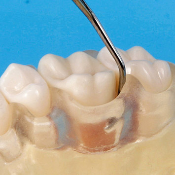 SRP Jaw Model [PER2001-UL-SC-FEM-32]