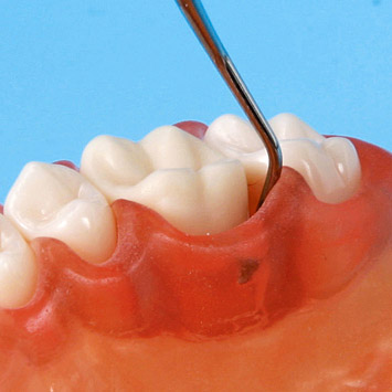 SRP Jaw Model [PER2001-UL-SCP-FEM-32]