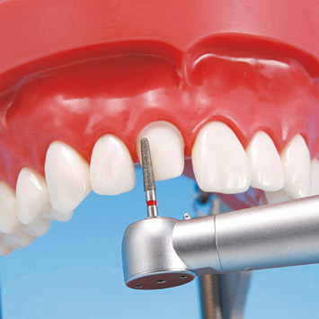 Hard Gingiva Jaw Model (32 teeth) [PRO2001-UL-HD-FEM-32]