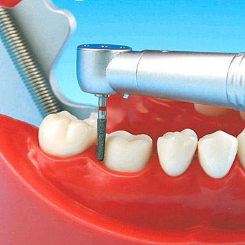 Hard Gingiva Jaw Model (32 teeth) [PRO2001-UL-HD-FEM-32]