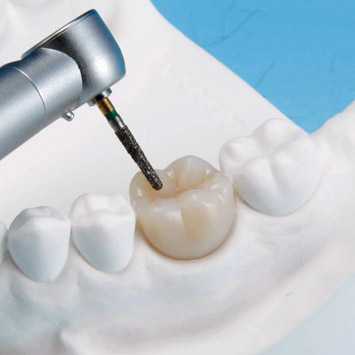Plaster Model Mold (32 teeth) [PRO2001-UL-MO-32]