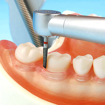 Prosthetic Restoration Jaw Model (32 teeth) [PRO2001-UL-SCP-FEM-32]