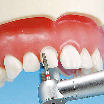 Prosthetic Restoration Jaw Model (28 teeth) [PRO2002-UL-SP-FEM-28]