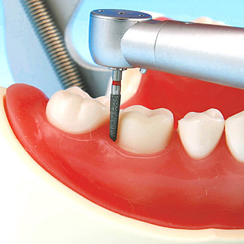 Prosthetic Restoration Jaw Model (28 teeth) [PRO2002-UL-SP-FEM-28]