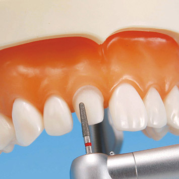 Prosthetic Restoration Jaw Model (28 teeth) [PRO2002-UL-UP-FEM-28]