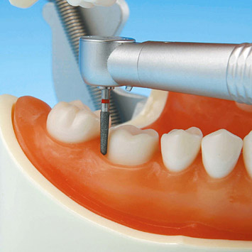 Prosthetic Restoration Jaw Model (28 teeth) [PRO2002-UL-UP-FEM-28]