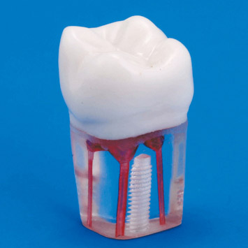 Endodontic Tooth Model [S12AN-200]