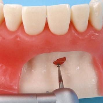 Oral Surgery Jaw Model [SUG1003-UL-SP-FEM-28]