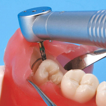 Oral Surgery Jaw Model [SUG1003-UL-SP-FEM-28]