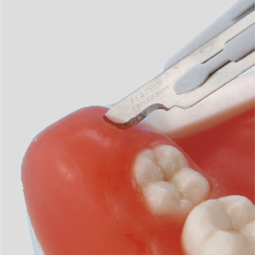 Oral Surgery Jaw Model [SUG1003-UL-SP-FEM-28] | Nissin Dental