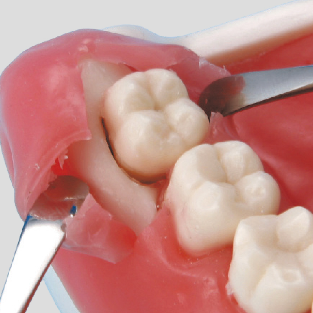 Oral Surgery Jaw Model [SUG1003-UL-SP-FEM-28]