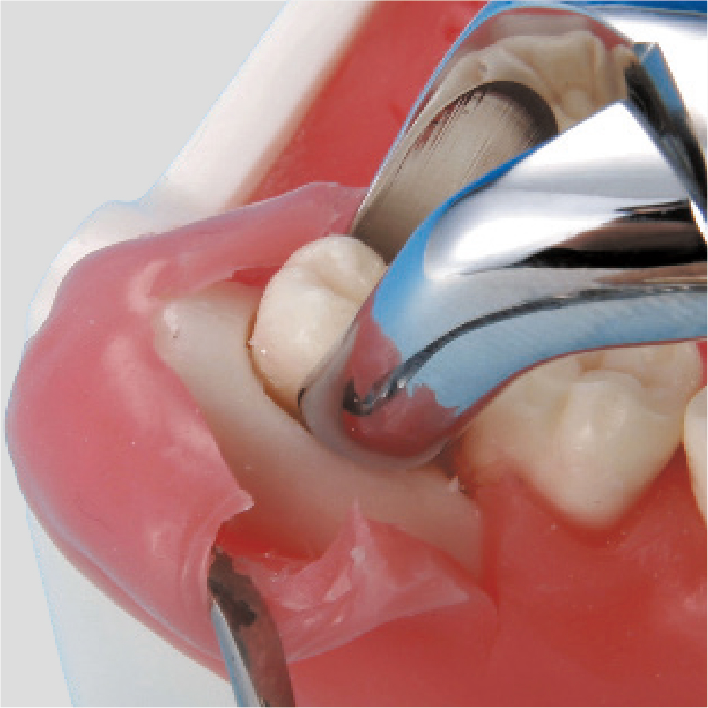 Oral Surgery Jaw Model [SUG1003-UL-SP-FEM-28] | Nissin Dental