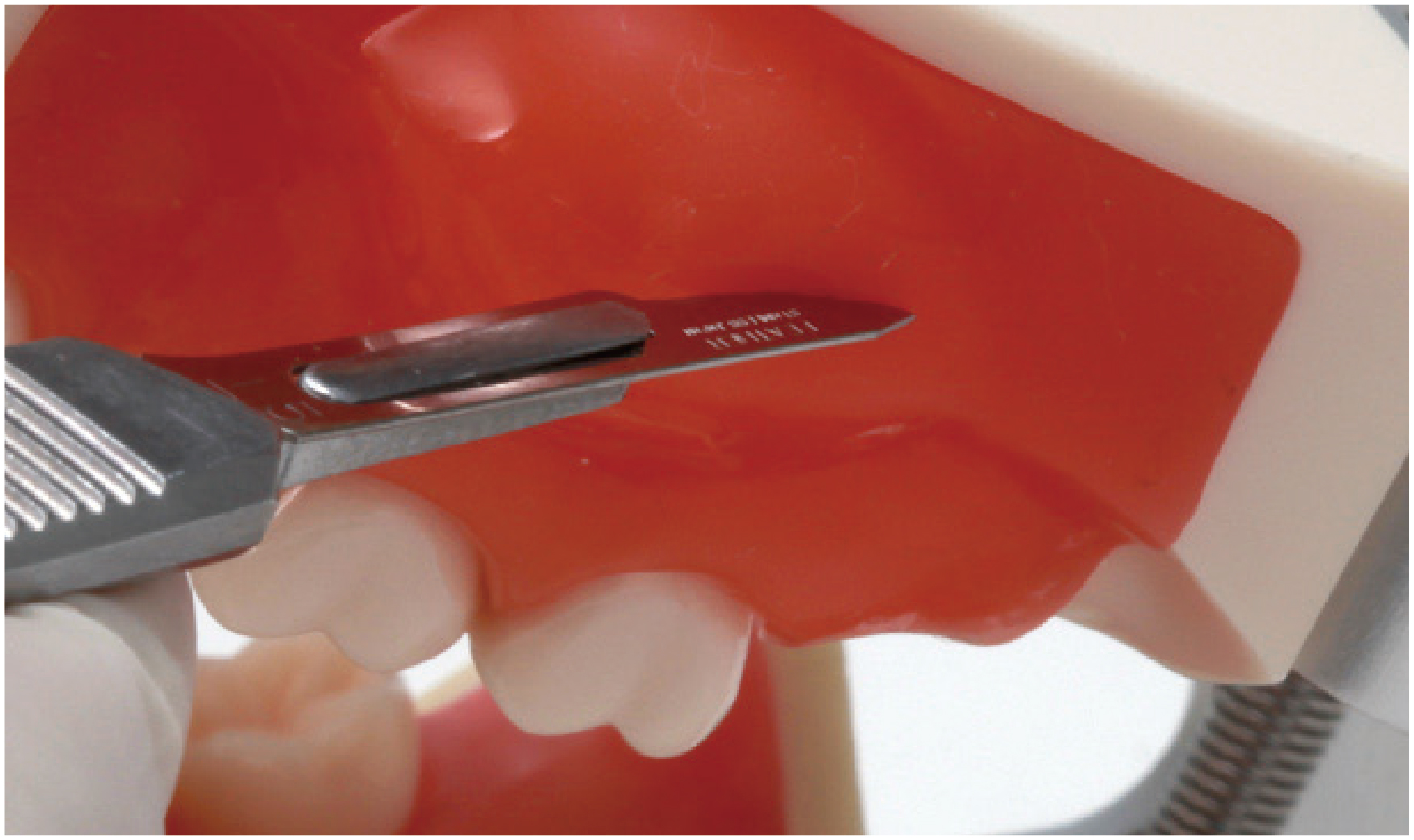 Abscess Incision/Suture Practice Model [SUG1008-T-EP]