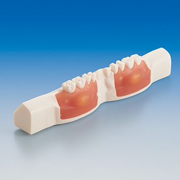 Abscess Incision/Suture Practice Model [SUG1008-T-EP]