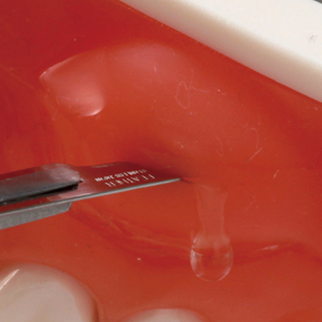 Abscess Incision/Suture Practice Model [SUG1008-T-EP]