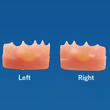 Abscess Incision/Suture Practice Model [SUG1008-T-EP]