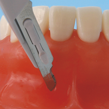 Apicoectomy Practice Model [SUG1009-T-SP]
