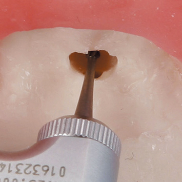 Apicoectomy Practice Model [SUG1009-T-SP]