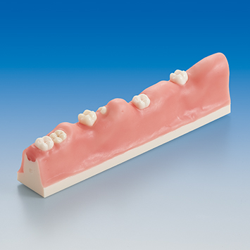 Impacted Tooth Exteaction Model [SUG1010-T-SP]