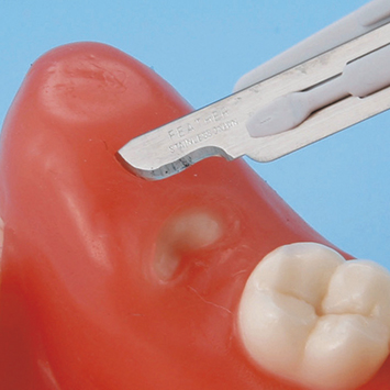 Impacted Tooth Exteaction Model [SUG1010-T-SP]