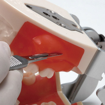 Incision/Pus Removal Model [SUG2001-UL-SP-FEM-28]