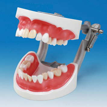 Tooth Extraction Model [SUG2004-UL-SP-DM-28]