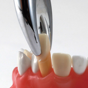 Tooth Extraction Model [SUG2004-UL-SP-DM-28]