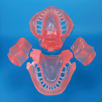 Gingiva for SUG2005-UL [SUG2005-GUL-SCP]