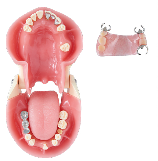 Oral Care Training Jaw Model (Complete Denture Care)[OHC1011-UL-SP]