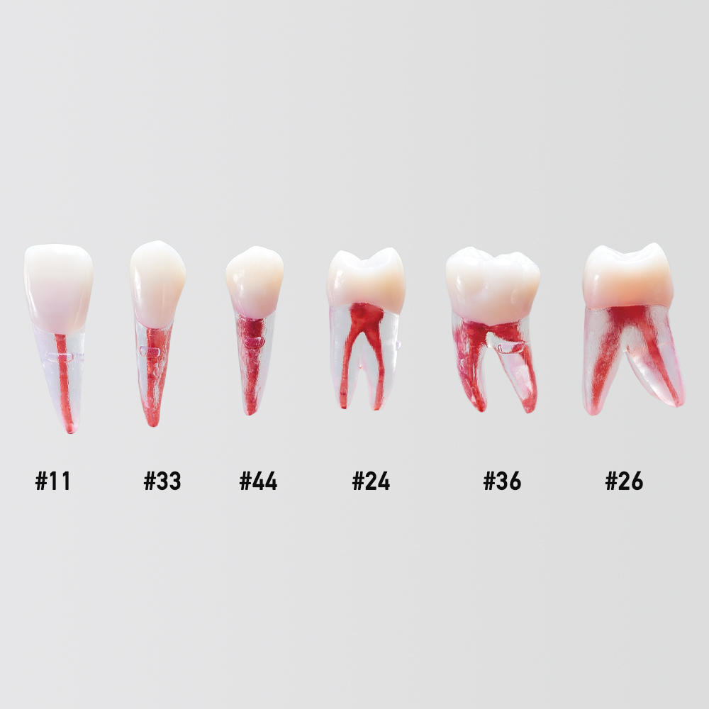 Anatomical Pulp Cavity & Root Model [B22XRAG-7 Series]