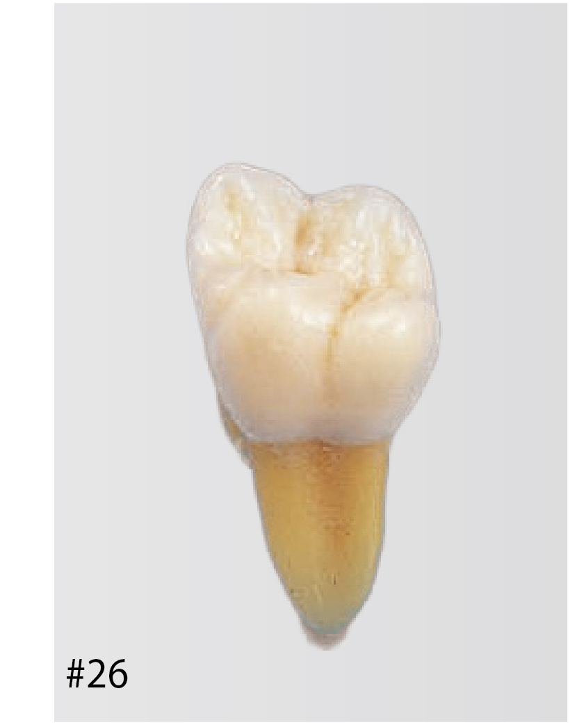 NISSIN 歯牙模型B3-1056253 Anatomical Tooth Model [B3-305] | Nissin Dental Products Inc