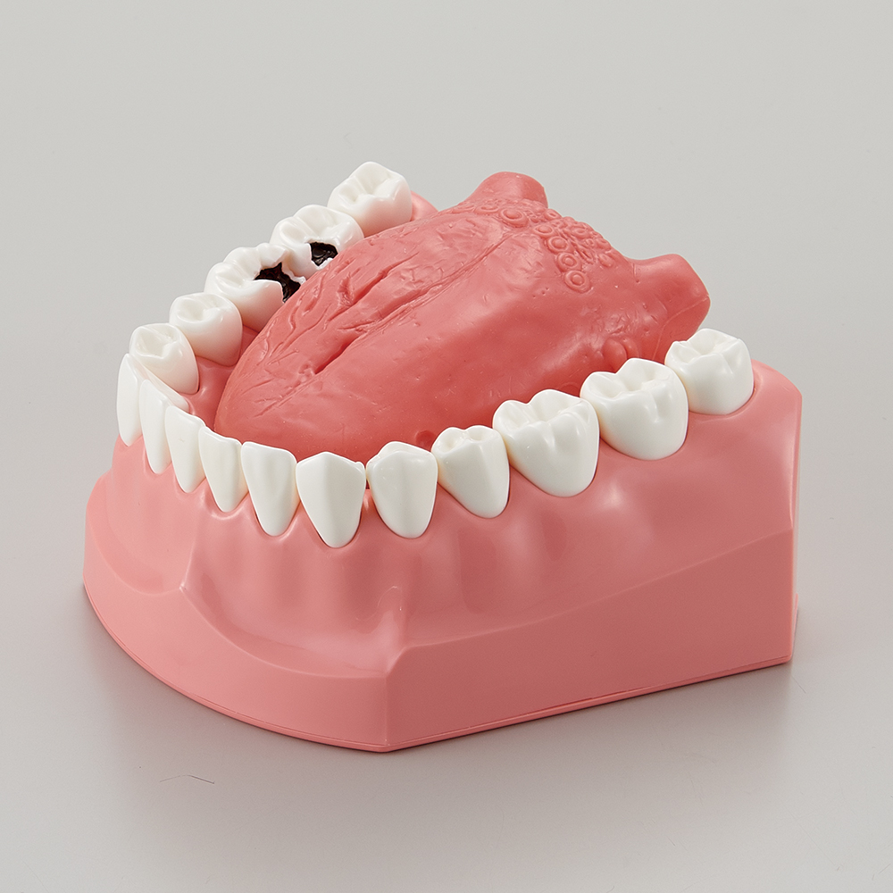 Tongue Disease Model [PE-STP026]