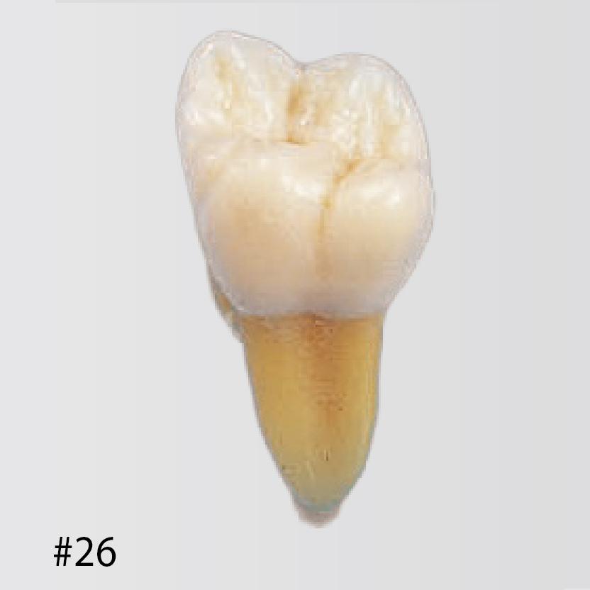 Modelo de Diente Anatómico [B3-305]