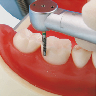 Modelo de Maxilar de Restauración Prostética (32 dientes) [PRO2001-UL-SP-FEM-32]