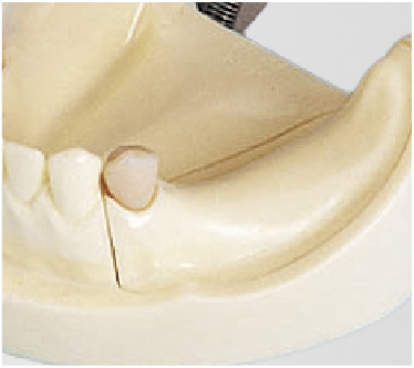 Modelo para Práctica de Implantes [IMP1001-UL-SP-FEM]