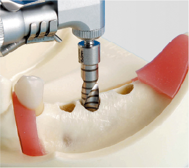 Modelo para Práctica de Implantes [IMP1001-UL-SP-FEM]