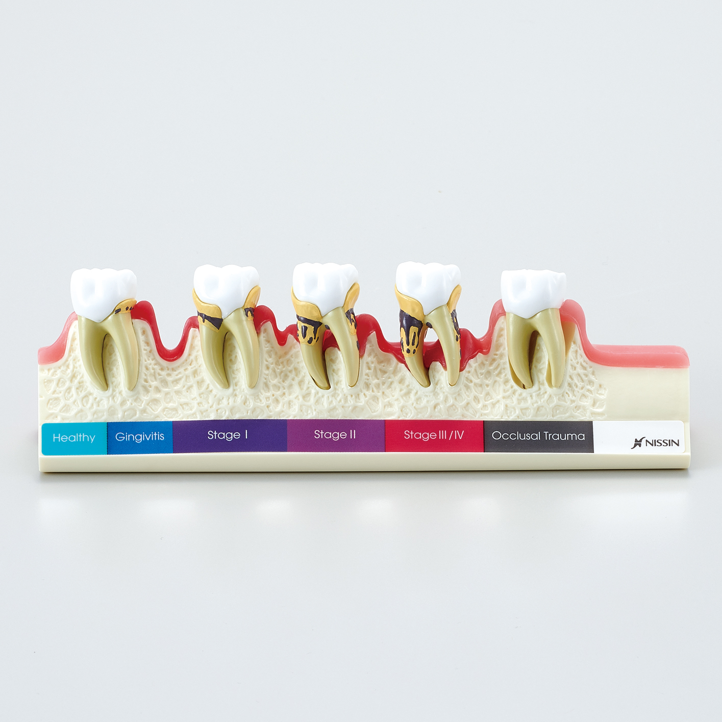 Modelo de Enfermedad Periodontal [PE-PER010]
