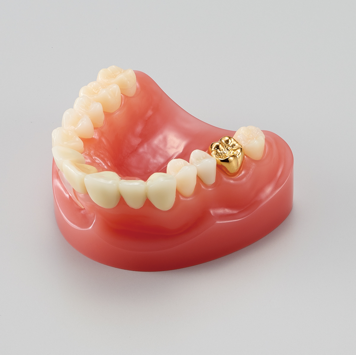 Modelo para Estudio de Prótesis/ Restauración Dental [PE-PRO001]