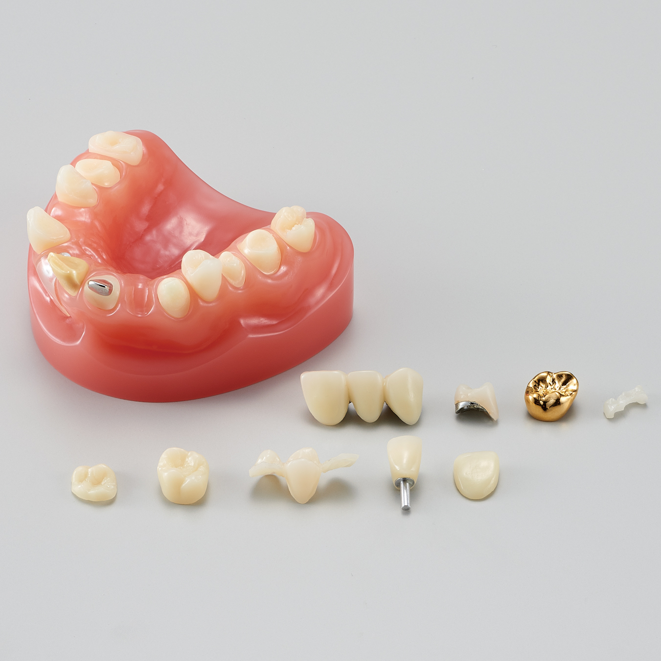 Modelo para Estudio de Prótesis/ Restauración Dental [PE-PRO001]