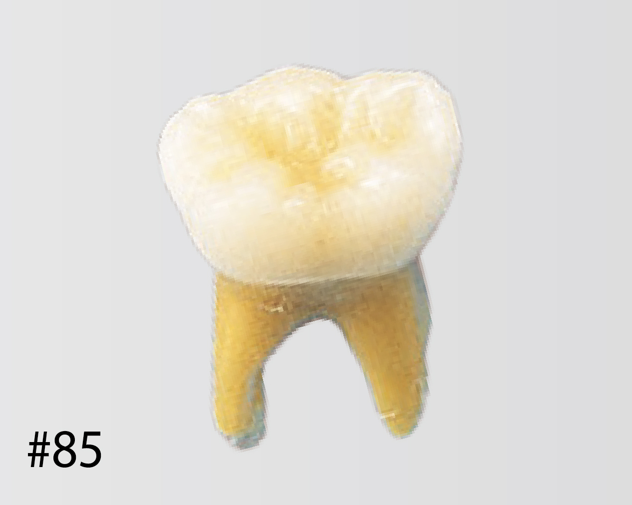 Modelo de Diente Anatómico [B4-309]